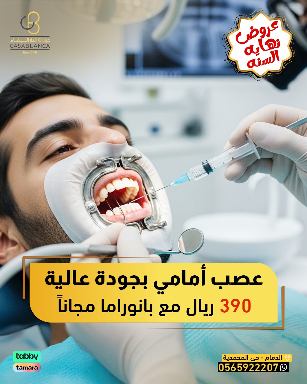 علاج عصب امامي + بانوراما مجاناً 